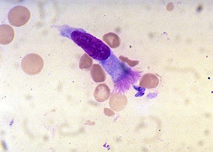Vista en microscopio del Toxoplasma Gondii, parásito de la toxoplasmosis