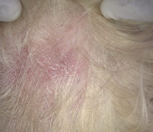 la dermatitis en perros