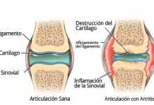 7 Signos de que tu mascota puede sufrir artritis