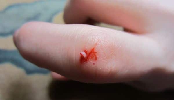 Por Qué Muerden Los Hámsters ? Causas y Qué Hacer Para Evitarlo